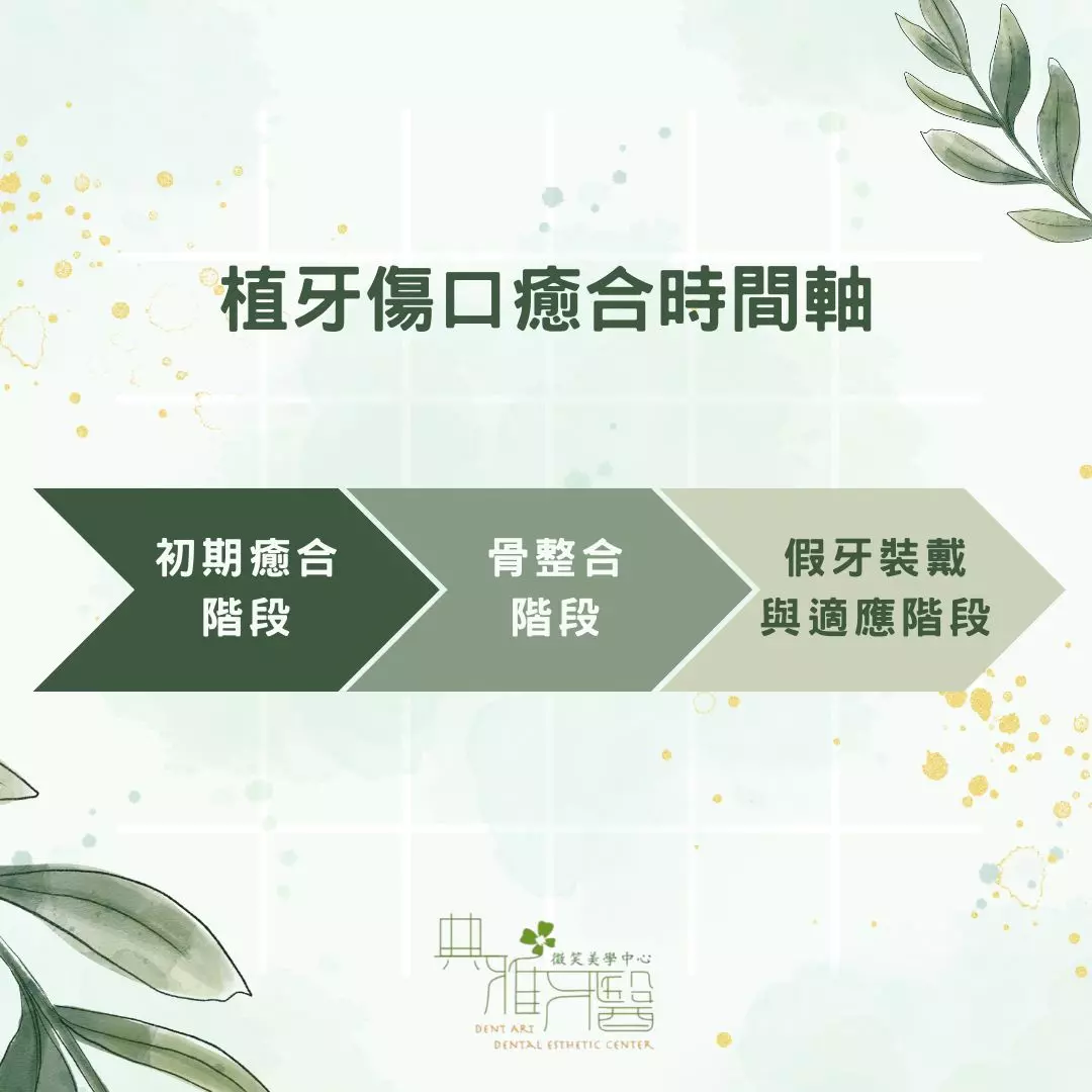 植牙傷口癒合時間有多久?一次搞懂植牙傷口癒合階段及過程 1 植牙傷口癒合時間軸