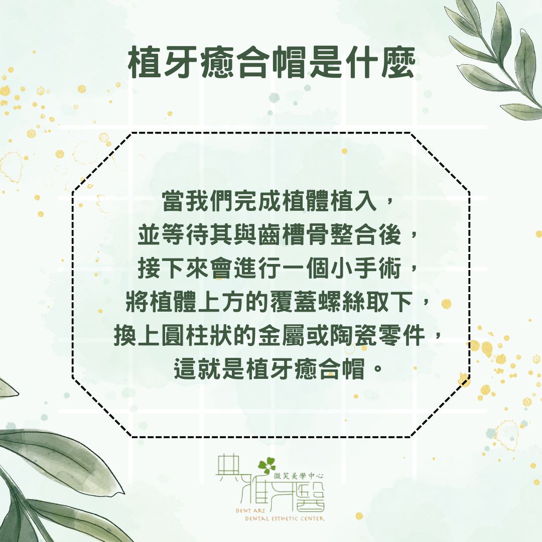 為什麼植牙癒合帽很重要?功能、脫落原因與保養方法 1 植牙癒合帽是什麼