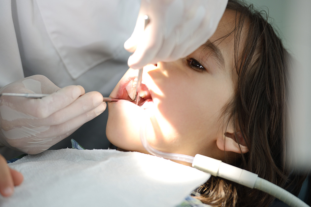 Read more about the article 牙齒抽神經費用要另外付嗎？說明根管治療費用哪些需要您自費