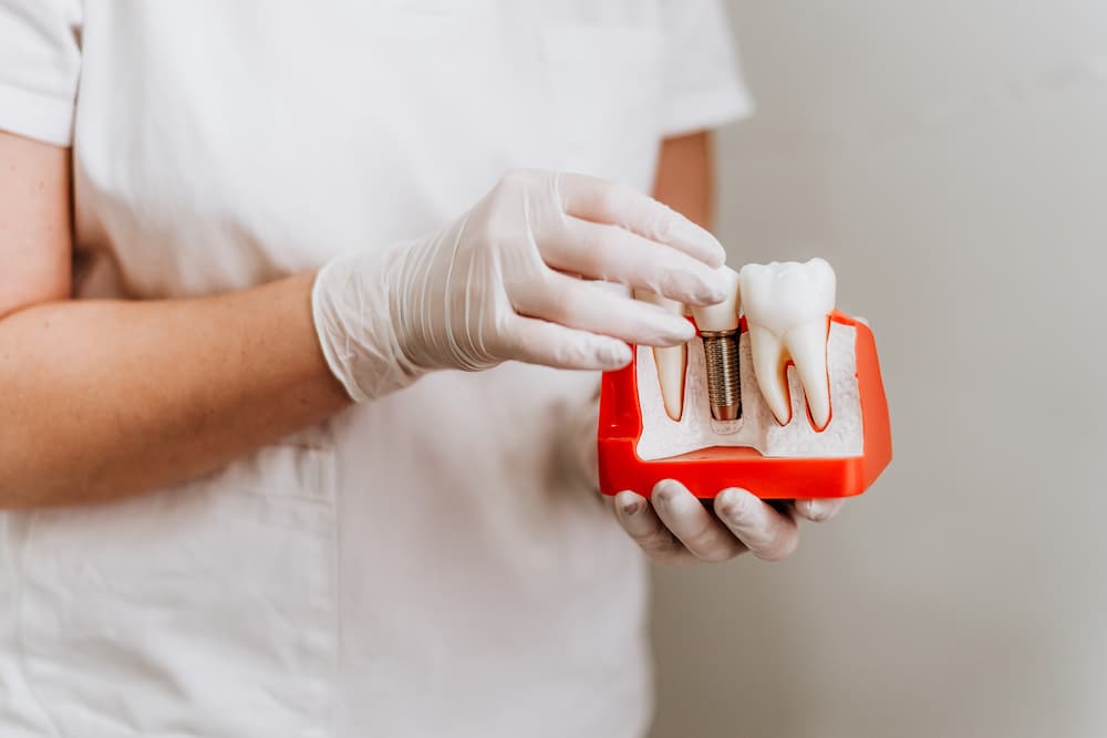 植牙補骨粉費用能不能省下來？