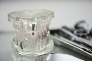 closeup of clear tooth implantation model with set 2023 06 15 23 45 02 utc