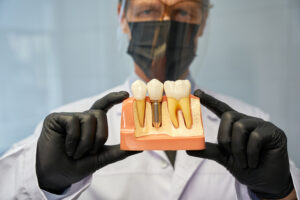serious dentist showing a teeth model with implant 2023 11 27 05 25 19 utc