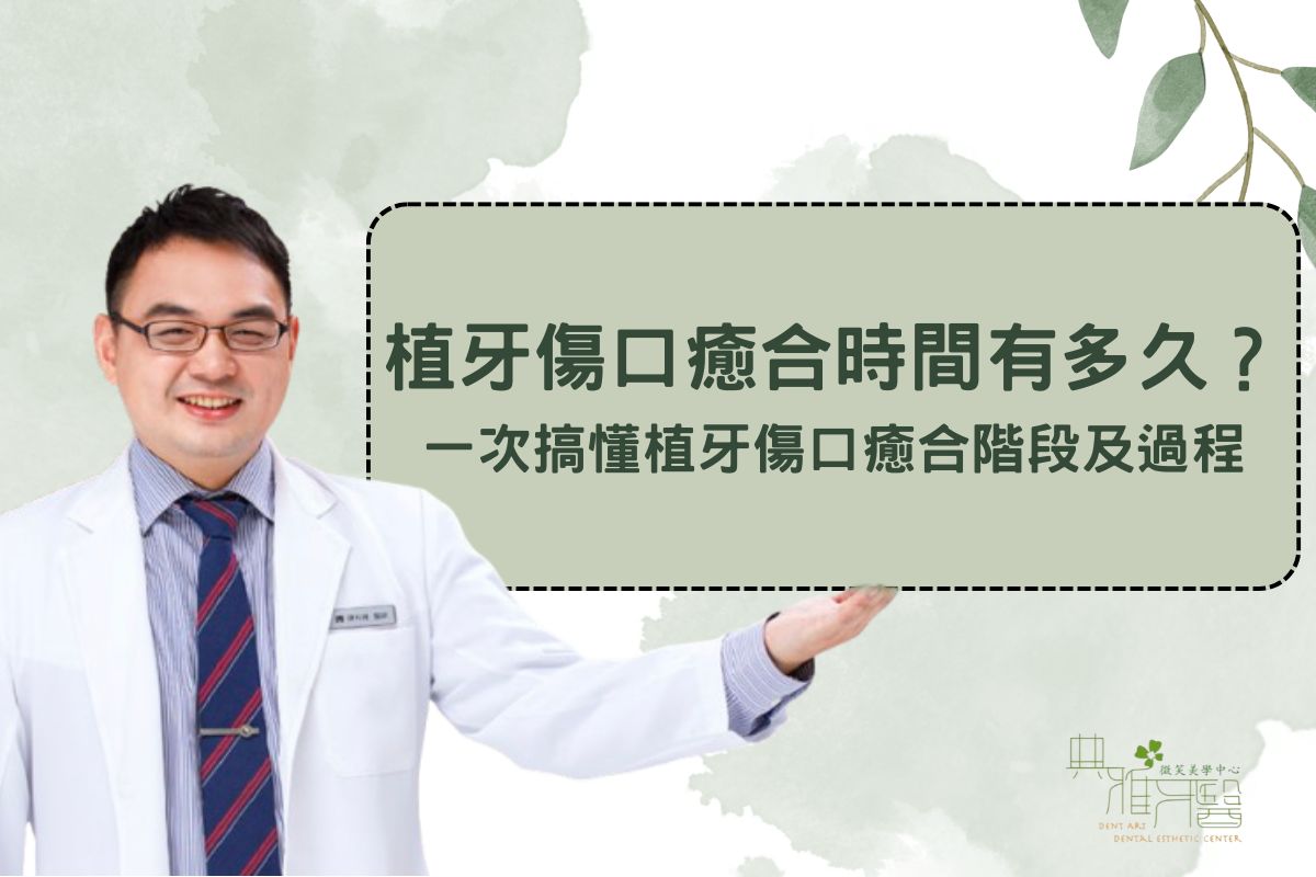 植牙傷口癒合時間有多久？一次搞懂植牙傷口癒合階段及過程