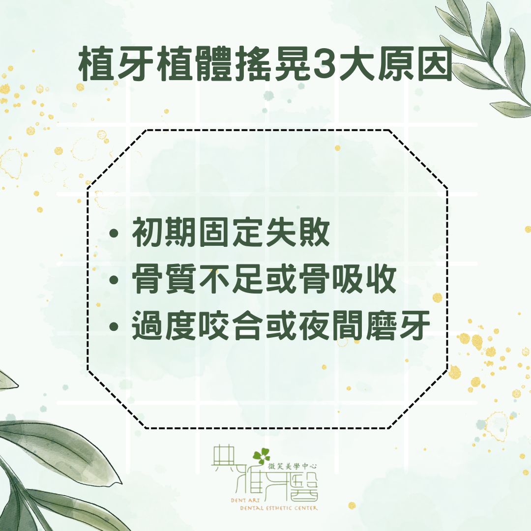 植牙植體搖晃怎麼辦?植牙搖晃3大原因和治療方式,讓你再也不怕植牙晃動 1 植牙植體搖晃3大原因