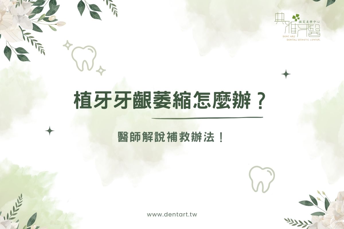 Read more about the article 植牙牙齦萎縮怎麼辦？醫師解說補救辦法
