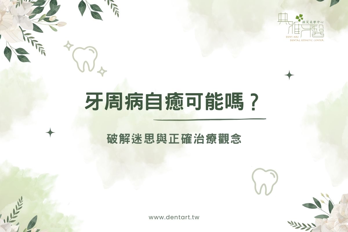 Read more about the article 牙周病自癒可能嗎？破解迷思與正確治療觀念