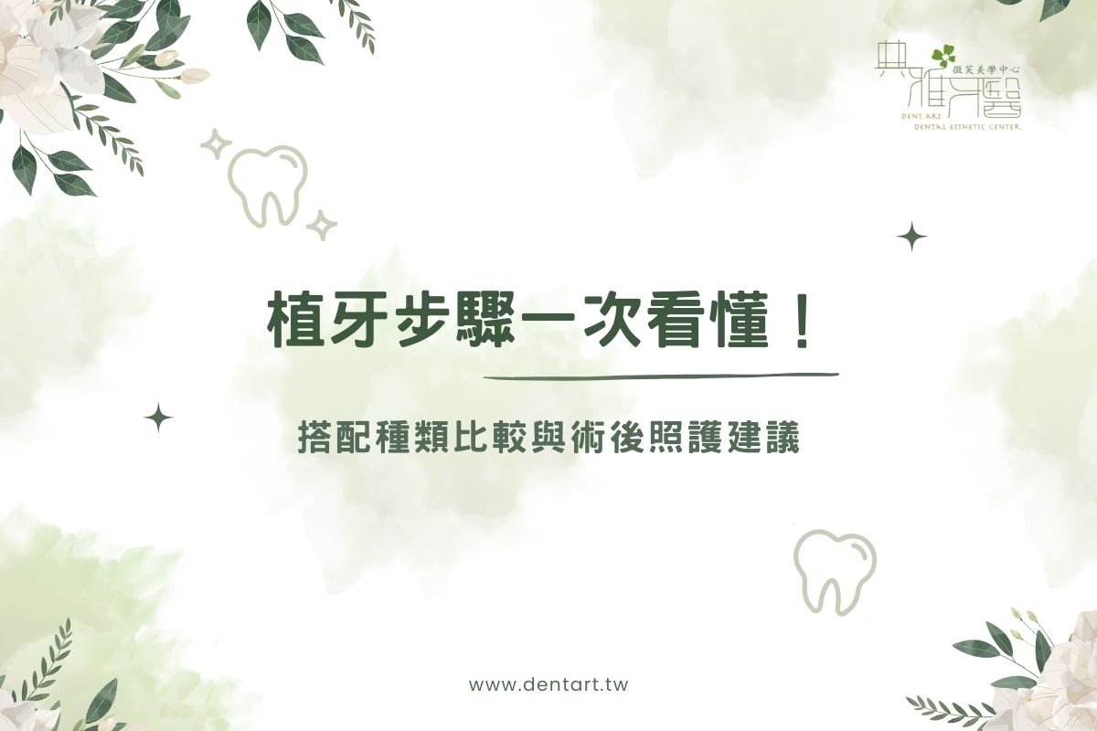 Read more about the article 植牙步驟一次看懂！搭配種類比較與術後照護建議