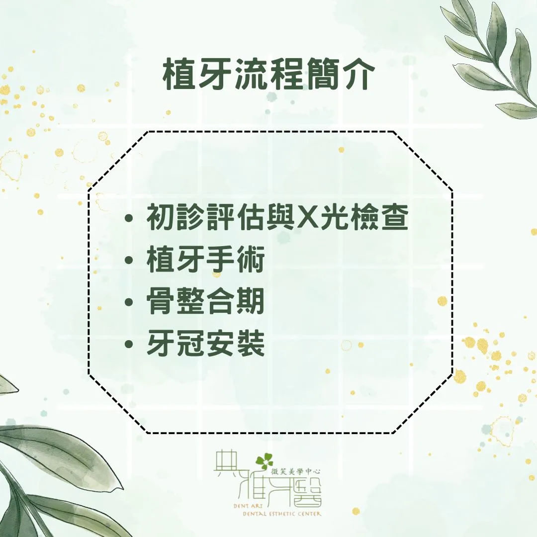 植牙流程簡介