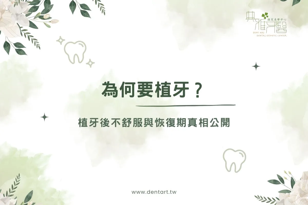 Read more about the article 為何要植牙？植牙後不舒服與恢復期真相公開