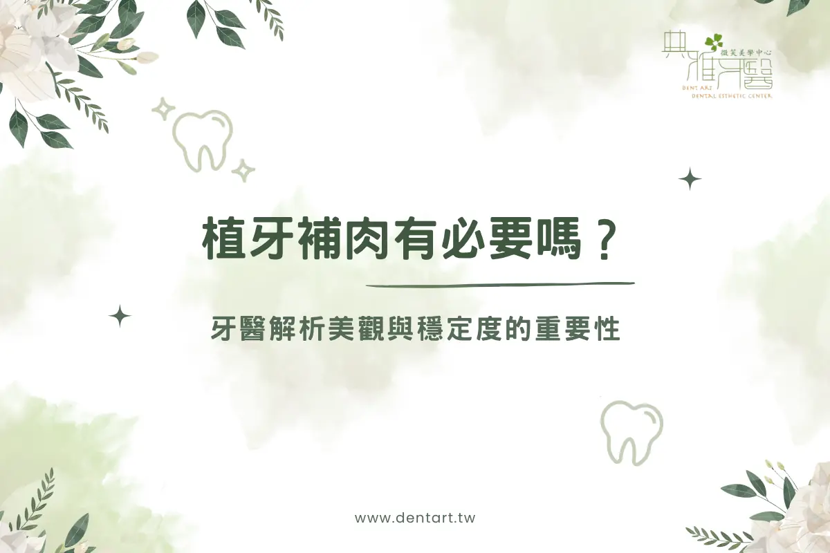 Read more about the article 植牙補肉有必要嗎？牙醫解析美觀與穩定度的重要性