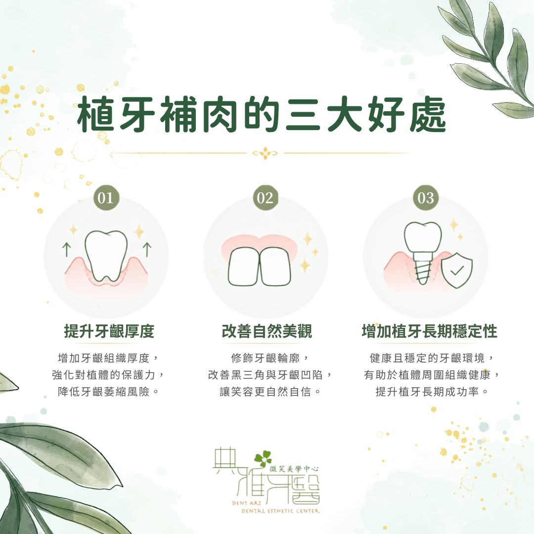 植牙補肉可提升牙齦厚度、改善自然美觀並增加植牙長期穩定性