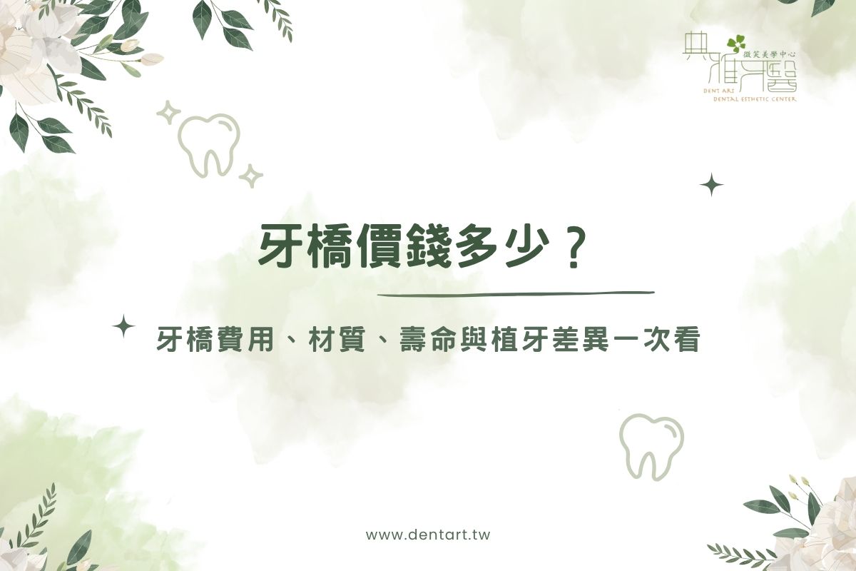 Read more about the article 牙橋價錢多少？2026牙橋費用、材質、壽命與植牙差異一次看
