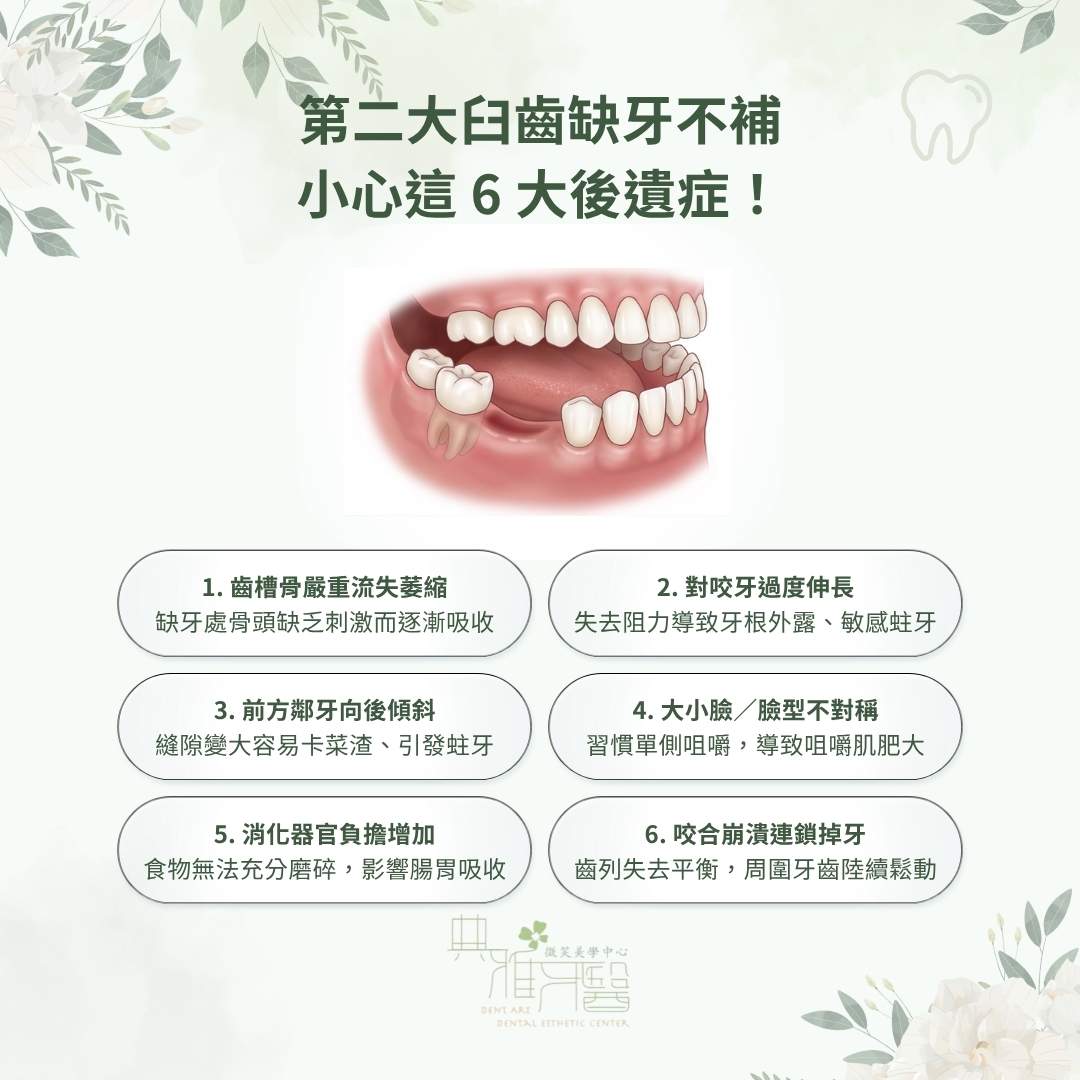 第二大臼齒缺牙不補，小心這 6 大後遺症！
