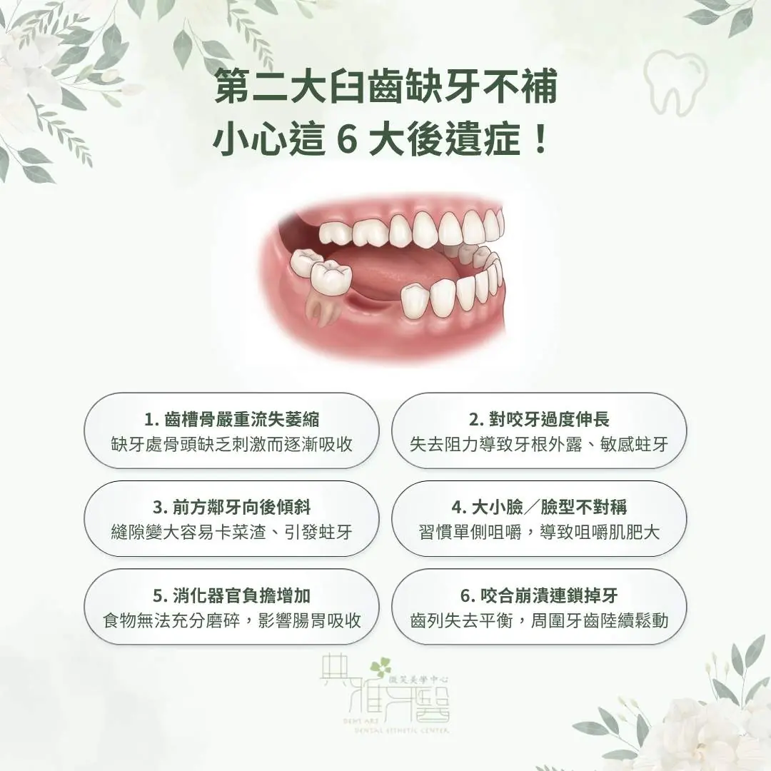 第二大臼齒缺牙不補，小心這 6 大後遺症！