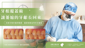 home 28 牙根覆蓋術 讓萎縮的牙齦長回來